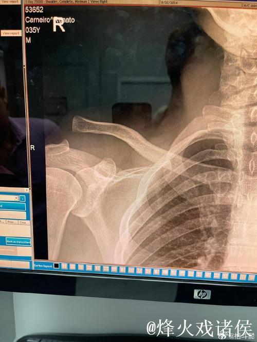 马纳里诺无情出击,瓦林卡满场飞奔疲于应对,四蛋无辜受虐 马纳里诺无情出击,瓦林卡满场飞奔疲于应对,四蛋无辜受虐